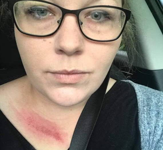 Woman hit by wing-mirror the day before her wedding