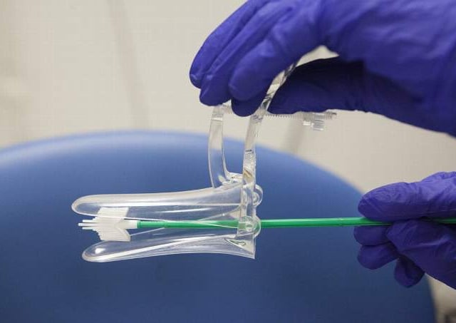 South West NHS aims to eliminate cervical cancer by 2040