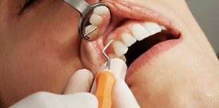 Council considers fluoride in water to improve oral health