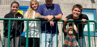 Ivybridge guitarist awake for brain operation