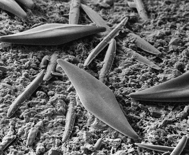 Nature Diary by Nigel Mortimer | Healthy Estuarine Scum?!