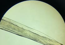 Vet Solves Vizsla's Eye Mystery